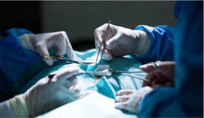hernia-mesh-400×232 https://legalcasereview.com/hernia-mesh/