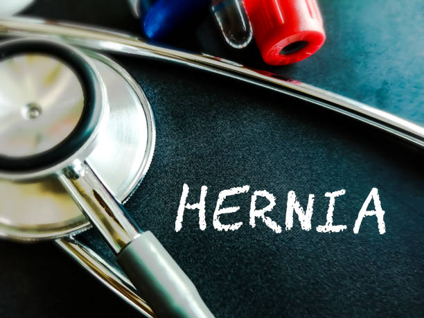 hernia mesh lawsuit compensation - Legal Case Review hernia mesh lawsuit compensation