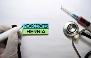 hernia mesh lawsuit compensation