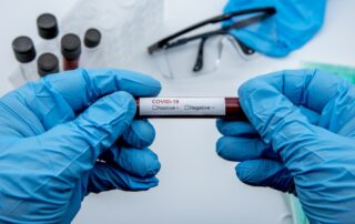 COVID-19 test and laboratory sample blood testing for diagnosis