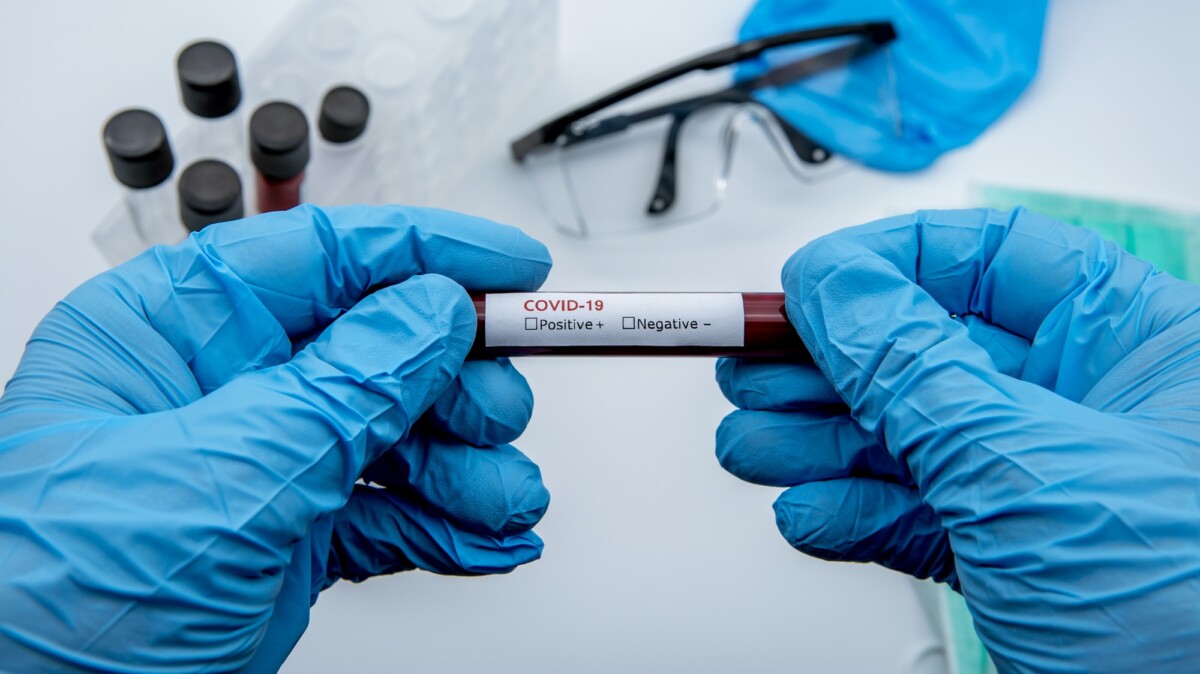 COVID-19 test and laboratory sample blood testing for diagnosis