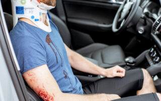 injury due to motor vehicle accident icd 10