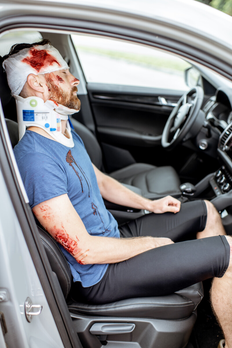 injured in a motor vehicle accident
